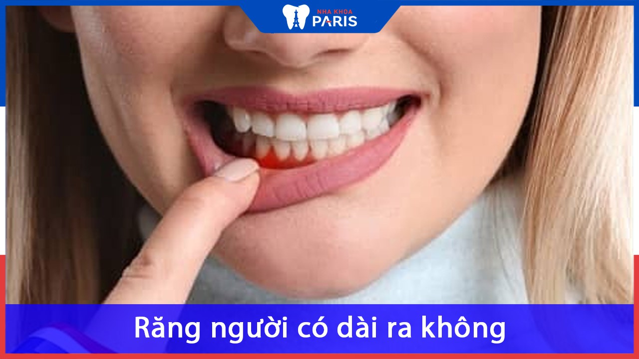 Răng người có dài ra không? Cách làm răng dài ra như thế nào?